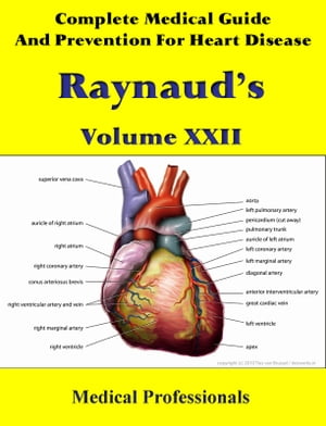 A Complete Medical Guide and Prevention For Heart Diseases Volume XXII; Raynaud’s