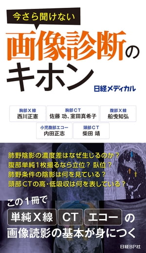 今さら聞けない画像診断のキホン【電子書籍】[ 西川 正憲 ]