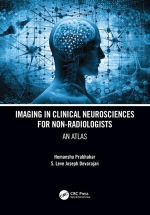 Imaging in Clinical Neurosciences for Non-radiologists