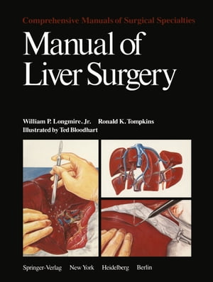 Manual of Liver Surgery【電子書籍】[ W.P. Longmire ]