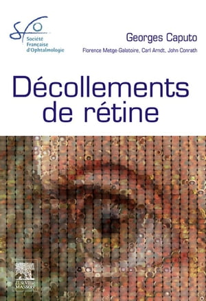 Décollements de rétine