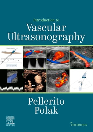 Introduction to Vascular Ultrasonography E-Book