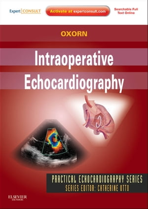 Intraoperative Echocardiography- E-BOOK