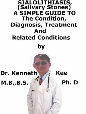 Sialolithiasis, (Salivary Stones) A Simple Guide To The Condition, Diagnosis, Treatment And Related Conditions