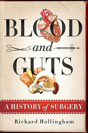 ŷKoboŻҽҥȥ㤨Blood and Guts A History of SurgeryŻҽҡ[ Richard Hollingham ]פβǤʤ18ߤˤʤޤ