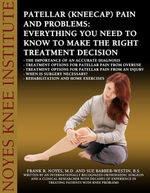 Patellar (Kneecap) Pain and Problems: Everything You Need to Know to Make the Right Treatment Decision