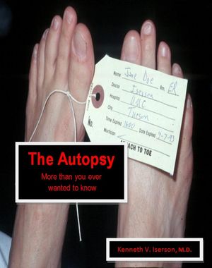 The Autopsy: More than you ever wanted to know