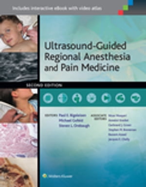 Ultrasound-Guided Regional Anesthesia and Pain Medicine【電子書籍】 Paul E. Bigeleisen