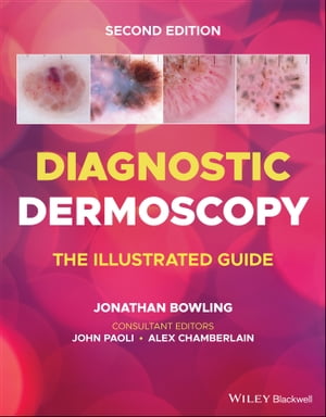 Diagnostic Dermoscopy The Illustrated Guide【
