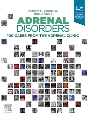 Adrenal Disorders Cases from the Adrenal Clinic