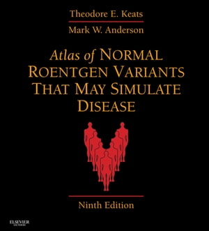 楽天楽天Kobo電子書籍ストアAtlas of Normal Roentgen Variants That May Simulate Disease Expert Consult - Enhanced Online Features【電子書籍】[ Theodore E. Keats ]