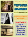 Thyroid Cancer Learn What Is Cause, Risk Factors, Symptoms, Diagnosis, Treatment...