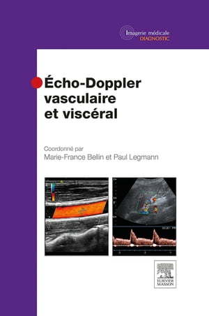 Echo-Doppler vasculaire et viscéral