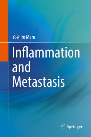 Inflammation and Metastasis