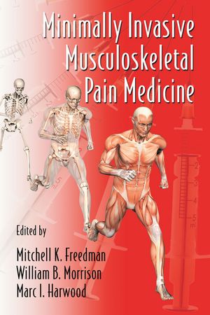 Minimally Invasive Musculoskeletal Pain Medicine【電子書籍】