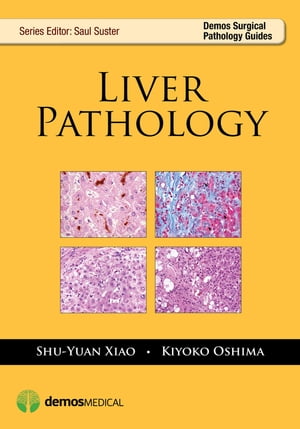 Liver Pathology【電子書籍】 Kiyoko Oshima, MD