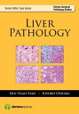 Liver Pathology【電子書籍】 Kiyoko Oshima, MD