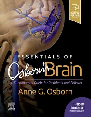 Essentials of Osborn's Brain E-Book