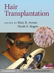 Hair Transplantation【電子書籍】[ Nicole E. Rogers, MD ]