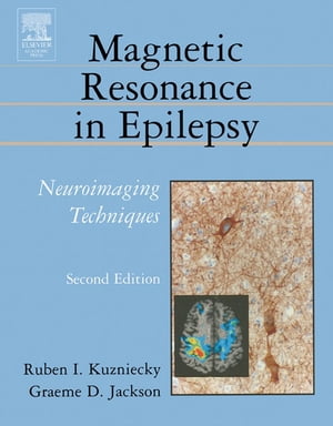 Magnetic Resonance in Epilepsy