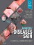 Andrews' Diseases of the Skin