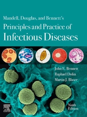 Mandell, Douglas, and Bennett's Principles and Practice of Infectious Diseases E-Book 2-Volume Set