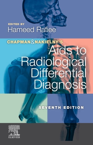 Chapman & Nakielny's Aids to Radiological Differential Diagnosis