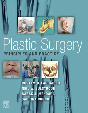 Plastic Surgery - Principles and Practice E-Book