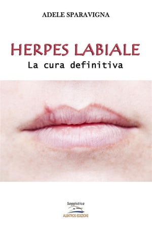 ŷKoboŻҽҥȥ㤨Herpes labiale ? La cura definitivaŻҽҡ[ Adele Sparavigna ]פβǤʤ887ߤˤʤޤ