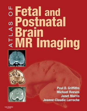 Atlas of Fetal and Infant Brain MR【電子書籍】[ Paul D. Griffiths ]