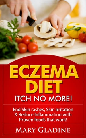 Eczema Diet: Itch No More! End Skin rashes, skin irritation & reduce inflammation with A Low Inflammation Diet & Proven foods that work! BONUS know what to avoid!【電子書籍】[ Mary Gladine ]