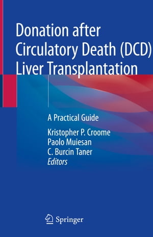 Donation after Circulatory Death (DCD) Liver Transplantation