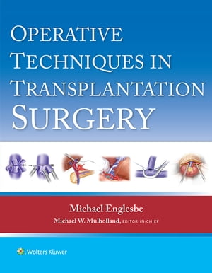 Operative Techniques in Transplantation Surgery【電子書籍】[ Michael J. Englesbe ]