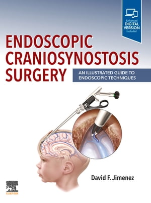 Endoscopic Craniosynostosis Surgery E-Book