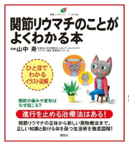 関節リウマチのことがよくわかる本【電子書籍】[ 山中寿 ]