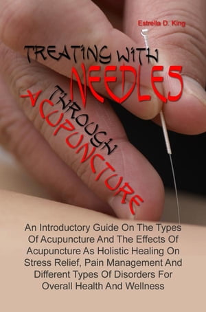 Treating With Needles through Acupuncture