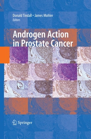 Androgen Action in Prostate Cancer