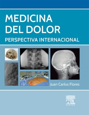 Medicina del dolor