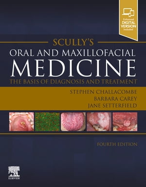 Scully’s Oral and Maxillofacial Medicine: The Basis of Diagnosis and Treatment