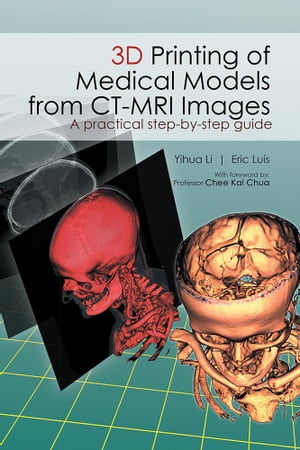 3D Printing of Medical Models from Ct-Mri Images