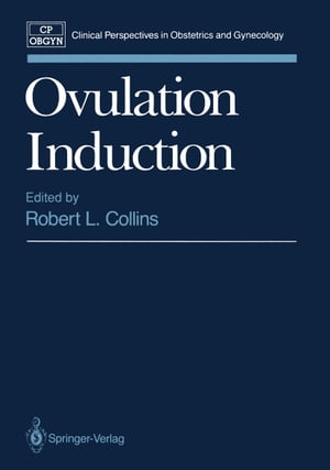 Ovulation Induction【電子書籍】