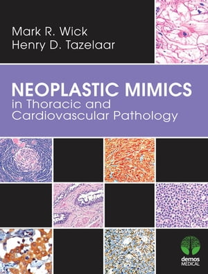 Neoplastic Mimics in Thoracic and Cardiovascular Pathology【電子書籍】 Mark R. Wick, MD