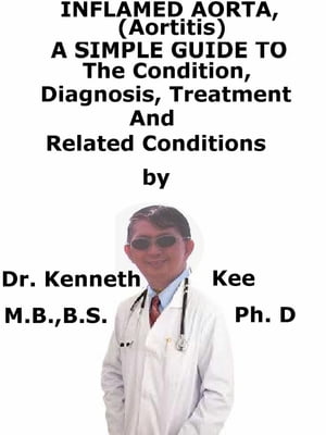 Inflamed Aorta, (Aortitis) A Simple Guide To The Condition, Diagnosis, Treatment And Related Conditions【電子書籍】[ Kenneth Kee ]