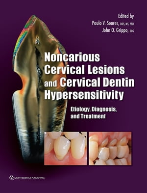 Noncarious Cervical Lesions and Cervical Dentin Hypersensitivity Etiology, Diagnosis, and Treatment【電子書籍】[ Paulo V. Soares ]