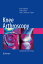 Knee Arthroscopy