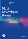 MRI of Gynaecological Diseases Illustrations and Cases【電子書籍】