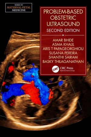 ＜p＞This book contains a series of clinical cases that address and illustrate difficult problems in obstetric ultrasound. The approach is strongly didactic and will aid trainees in maternal-fetal medicine and obstetrics to appreciate potential pitfalls and recognize rare presentations. Each case sets out one page of text, then one of treatment algorithms, and then presents sample ultrasound scans. Learning objectives are given for each case, together with a short list of references and background reading.＜/p＞画面が切り替わりますので、しばらくお待ち下さい。 ※ご購入は、楽天kobo商品ページからお願いします。※切り替わらない場合は、こちら をクリックして下さい。 ※このページからは注文できません。