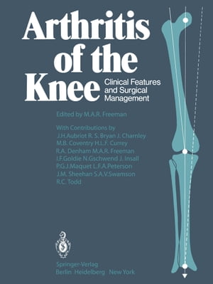 Arthritis of the Knee