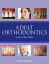 Adult Orthodontics