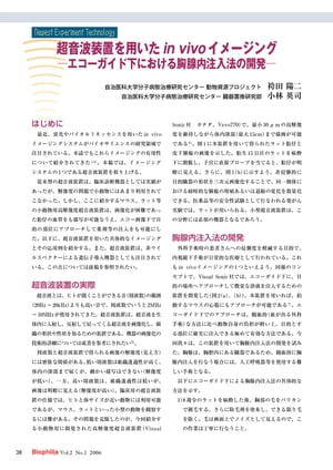 最新実験技術 : 第5回 超音波装置を用いたin vivo イメージング ーエコーガイド下における胸腺内注入法..